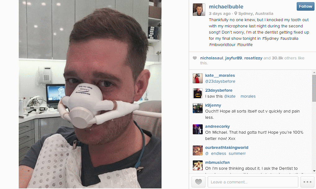 Michael Buble knocked out his own tooth